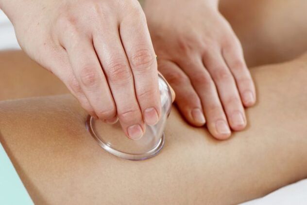 cupar massage for varicose veins