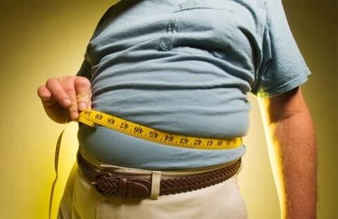 being overweight provokes the development of varicose veins