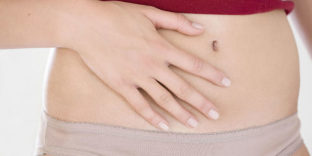 pelvic varices in women