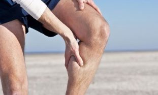 varicose veins in the legs, males
